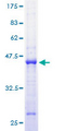 MRPL23 Protein - 12.5% SDS-PAGE of human MRPL23 stained with Coomassie Blue