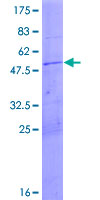 MRPL24 Protein - 12.5% SDS-PAGE of human MRPL24 stained with Coomassie Blue