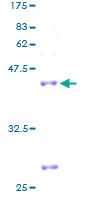 MRPL27 Protein - 12.5% SDS-PAGE of human MRPL27 stained with Coomassie Blue