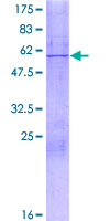 MRPL28 Protein - 12.5% SDS-PAGE of human MRPL28 stained with Coomassie Blue