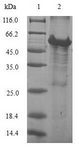 MRPL28 Protein - (Tris-Glycine gel) Discontinuous SDS-PAGE (reduced) with 5% enrichment gel and 15% separation gel.