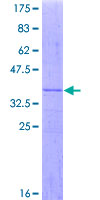 MRPL28 Protein - 12.5% SDS-PAGE Stained with Coomassie Blue.