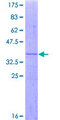 MRPL28 Protein - 12.5% SDS-PAGE Stained with Coomassie Blue.