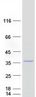 MRPL28 Protein - Purified recombinant protein MRPL28 was analyzed by SDS-PAGE gel and Coomassie Blue Staining