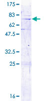 MRPL3 Protein - 12.5% SDS-PAGE of human MRPL3 stained with Coomassie Blue