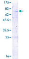 MRPL3 Protein - 12.5% SDS-PAGE of human MRPL3 stained with Coomassie Blue