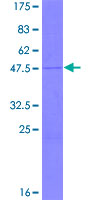 MRPL30 Protein - 12.5% SDS-PAGE of human MRPL30 stained with Coomassie Blue