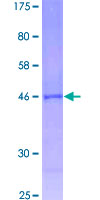 MRPL32 Protein - 12.5% SDS-PAGE of human MRPL32 stained with Coomassie Blue