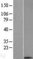 MRPL33 Protein - Western validation with an anti-DDK antibody * L: Control HEK293 lysate R: Over-expression lysate