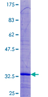 MRPL33 Protein - 12.5% SDS-PAGE of human MRPL33 stained with Coomassie Blue