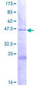 MRPL35 Protein - 12.5% SDS-PAGE of human MRPL35 stained with Coomassie Blue