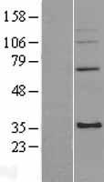 MRPL4 / MRP-L4 Protein - Western validation with an anti-DDK antibody * L: Control HEK293 lysate R: Over-expression lysate