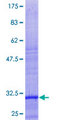 MRPL40 Protein - 12.5% SDS-PAGE Stained with Coomassie Blue.