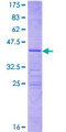 MRPL41 / PIG3 / BMRP Protein - 12.5% SDS-PAGE of human MRPL41 stained with Coomassie Blue