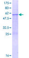 MRPL46 Protein - 12.5% SDS-PAGE of human MRPL46 stained with Coomassie Blue