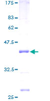 MRPL51 Protein - 12.5% SDS-PAGE of human MRPL51 stained with Coomassie Blue