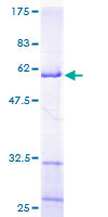 MRPL9 Protein - 12.5% SDS-PAGE of human MRPL9 stained with Coomassie Blue