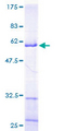 MRPL9 Protein - 12.5% SDS-PAGE of human MRPL9 stained with Coomassie Blue