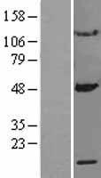 MRPS10 Protein - Western validation with an anti-DDK antibody * L: Control HEK293 lysate R: Over-expression lysate
