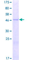 MRPS10 Protein - 12.5% SDS-PAGE of human MRPS10 stained with Coomassie Blue