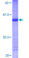 MRPS14 Protein - 12.5% SDS-PAGE of human MRPS14 stained with Coomassie Blue