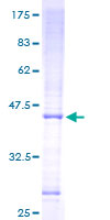 MRPS16 Protein - 12.5% SDS-PAGE of human MRPS16 stained with Coomassie Blue