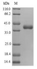 MRPS16 Protein - (Tris-Glycine gel) Discontinuous SDS-PAGE (reduced) with 5% enrichment gel and 15% separation gel.