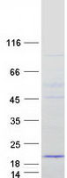 MRPS16 Protein - Purified recombinant protein MRPS16 was analyzed by SDS-PAGE gel and Coomassie Blue Staining