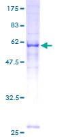 MRPS2 Protein - 12.5% SDS-PAGE of human MRPS2 stained with Coomassie Blue