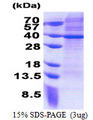 MRPS2 Protein
