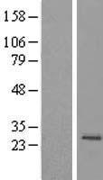 MRPS23 Protein - Western validation with an anti-DDK antibody * L: Control HEK293 lysate R: Over-expression lysate