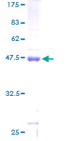 MRPS25 Protein - 12.5% SDS-PAGE of human MRPS25 stained with Coomassie Blue