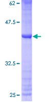 MRPS33 Protein - 12.5% SDS-PAGE of human MRPS33 stained with Coomassie Blue
