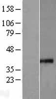 MRPS35 Protein - Western validation with an anti-DDK antibody * L: Control HEK293 lysate R: Over-expression lysate