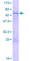 MRPS35 Protein - 12.5% SDS-PAGE of human MRPS35 stained with Coomassie Blue