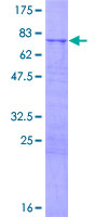 MRPS5 Protein - 12.5% SDS-PAGE of human MRPS5 stained with Coomassie Blue