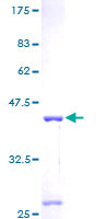MRPS6 / MRP S6 Protein - 12.5% SDS-PAGE of human MRPS6 stained with Coomassie Blue