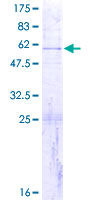 MRPS7 Protein - 12.5% SDS-PAGE of human MRPS7 stained with Coomassie Blue