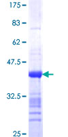 MRRF Protein - 12.5% SDS-PAGE Stained with Coomassie Blue.