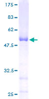 MRTO4 Protein - 12.5% SDS-PAGE of human C1orf33 stained with Coomassie Blue