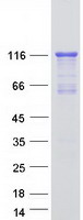 MRVI1 Protein - Purified recombinant protein MRVI1 was analyzed by SDS-PAGE gel and Coomassie Blue Staining