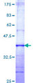 MS / MTR Protein - 12.5% SDS-PAGE Stained with Coomassie Blue.