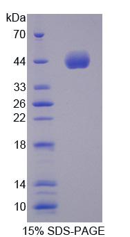 MS / MTR Protein - Recombinant  5-Methyltetrahydrofolate Homocysteine Methyltransferase By SDS-PAGE