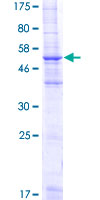MS4A2 / FCERI Protein - 12.5% SDS-PAGE of human MS4A2 stained with Coomassie Blue