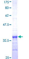 MS4A2 / FCERI Protein - 12.5% SDS-PAGE Stained with Coomassie Blue.