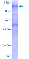 MS4A3 Protein - 12.5% SDS-PAGE of human MS4A3 stained with Coomassie Blue