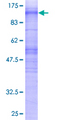 MS4A3 Protein - 12.5% SDS-PAGE of human MS4A3 stained with Coomassie Blue