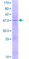 MS4A4A Protein - 12.5% SDS-PAGE of human MS4A4A stained with Coomassie Blue