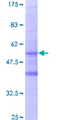 MS4A6A / MS4A Protein - 12.5% SDS-PAGE of human MS4A6A stained with Coomassie Blue