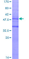 MS4A6A / MS4A Protein - 12.5% SDS-PAGE of human MS4A6A stained with Coomassie Blue